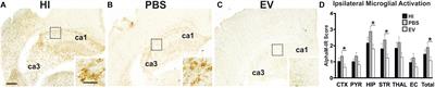 Mesenchymal Stromal Cell Derived Extracellular Vesicles Reduce Hypoxia-Ischaemia Induced Perinatal Brain Injury